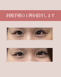 スタッフブログ